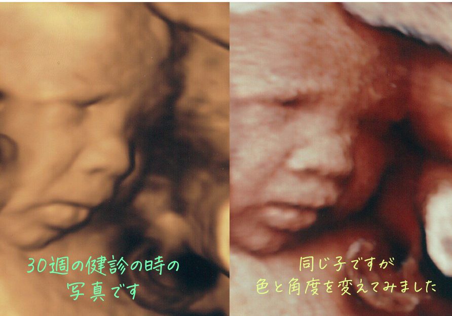 4dエコー画像 こうちウィメンズクリニック 4dエコー画像 こうちウィメンズクリニック